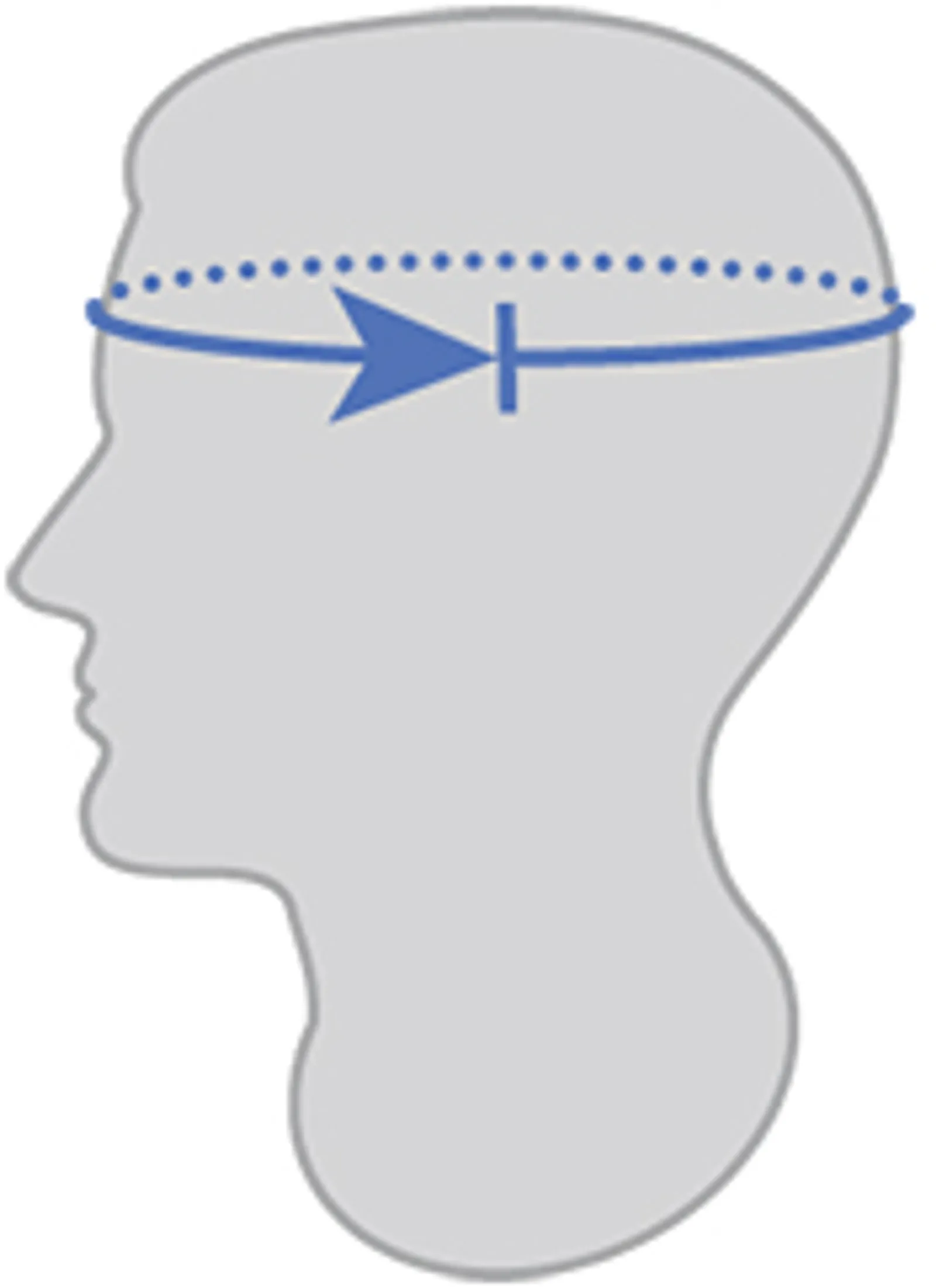 A schematic illustration of a male head with a blue arrow line indicating head circumference measurement.
